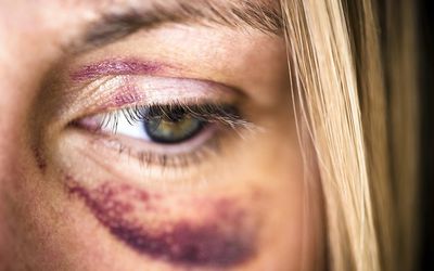 Criminal Injury Compensation Guide For Victims