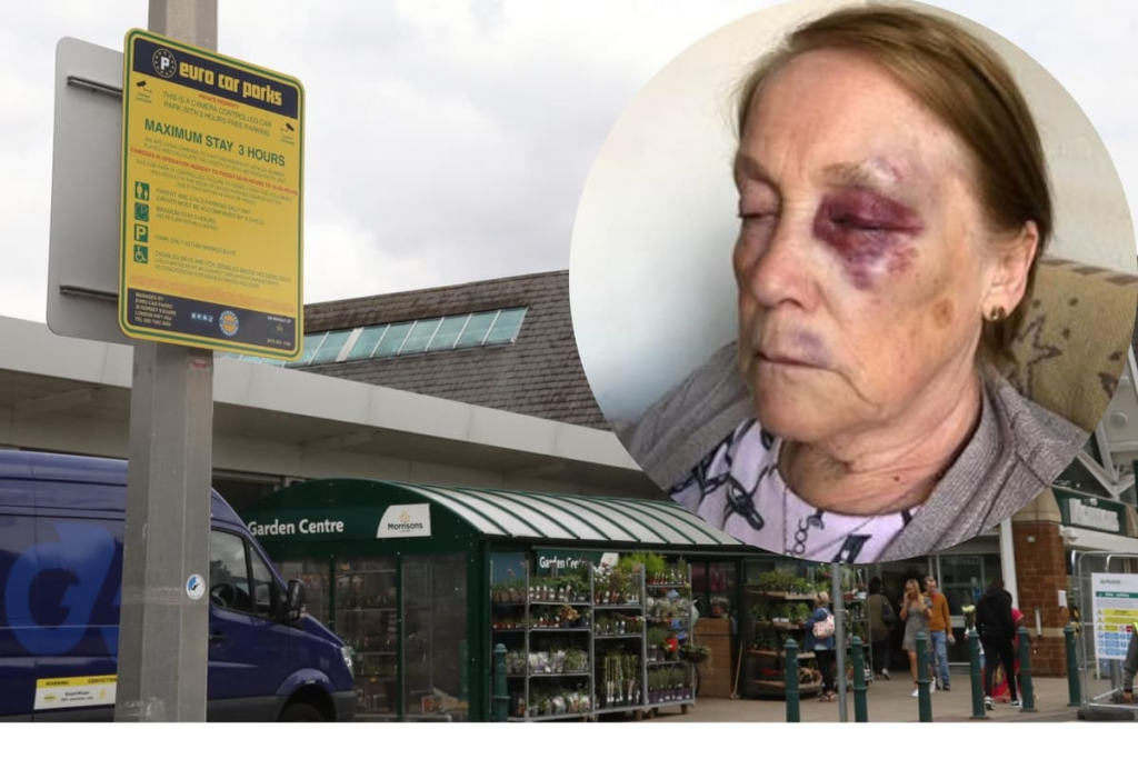 Compensation for a Facial Injury from Tripping in Morrisons
